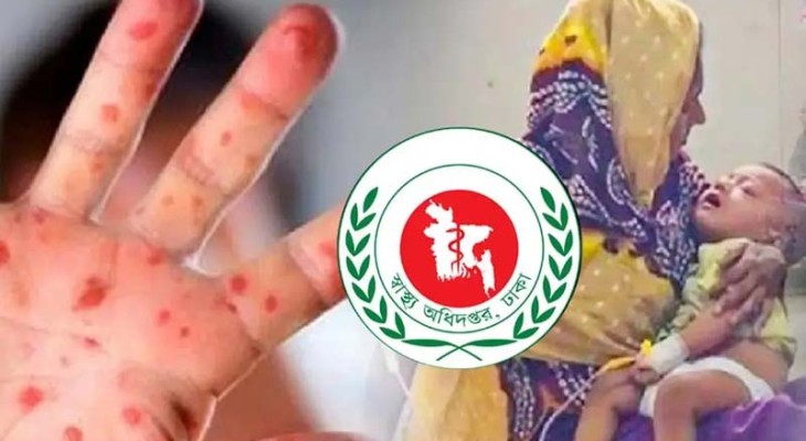 ১৭ দিনে ১৩ শিশুর মৃত্যু: হামের লক্ষণ, নিউমোনিয়া আর টিকার সংকটে ময়মনসিংহে উৎকণ্ঠা
